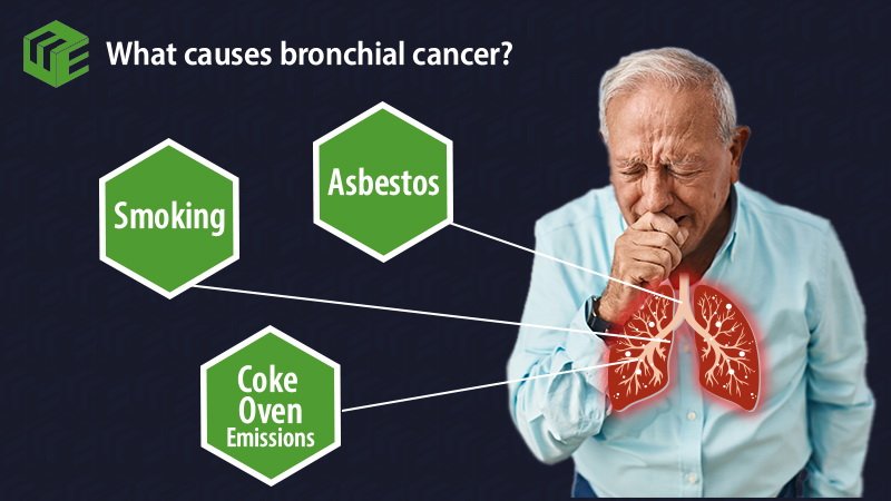 Bronchial cancer claims video