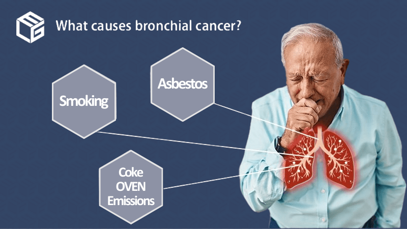 Bronchial cancer claims video
