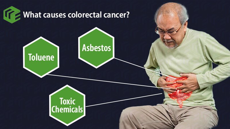 Colorectal cancer claims video