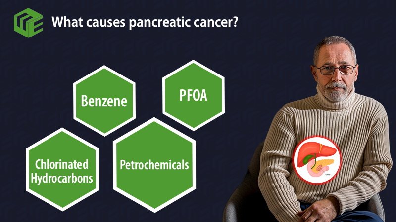 Pancreatic cancer claims video
