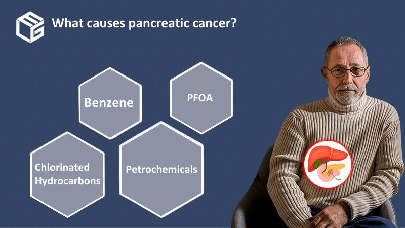 Pancreatic cancer claims video