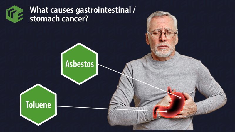 Gastrointestinal / stomach cancer video